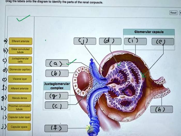 Art-labeling activity the renal corpuscle