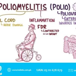 All of the following are true of poliomyelitis except