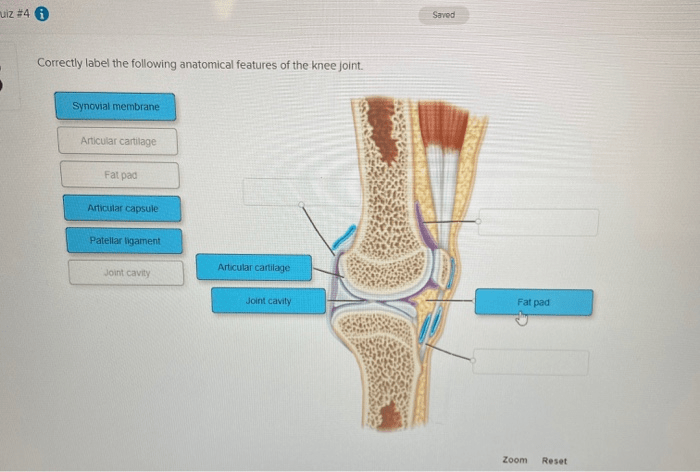 Correctly identify the following anatomical parts of the glenohumeral joint